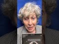 Balloon Sinus Dilation in office 4 weeks ago and doing well