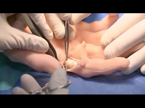 Vidéo: Comment choisir un chirurgien pour une chirurgie de pointe : 12 étapes