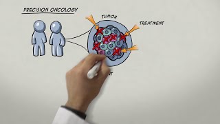 Chasing Metastatic Cancer Cells