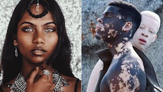 10 Unique People With Rare Beauty Who Are one in a Million