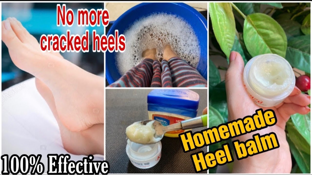 Freedom From Cracked Heels! Get Soft, Smooth Feet With These Incredible DIY  Foot Salves