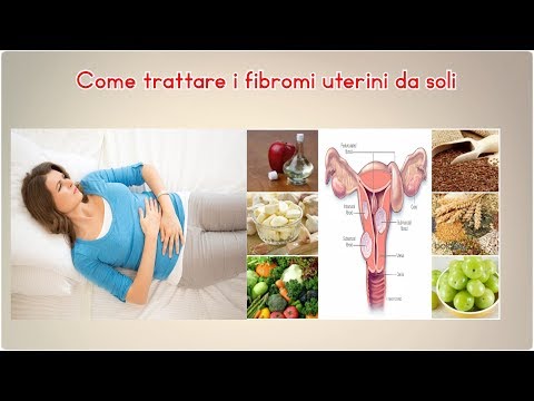 Come trattare i fibromi uterini da soli