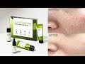 SOME BY MI Super Matcha Pore Care Starter Kit Review 썸바이미 리뷰 | Pores & Blackheads | Korean Skincare