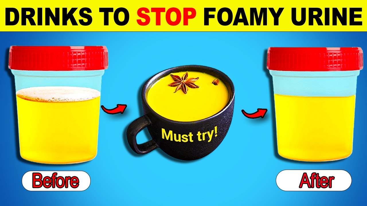 Top 9 Drinks To Stop Proteinuria and Heal Your Kidneys | Healthy Every ...