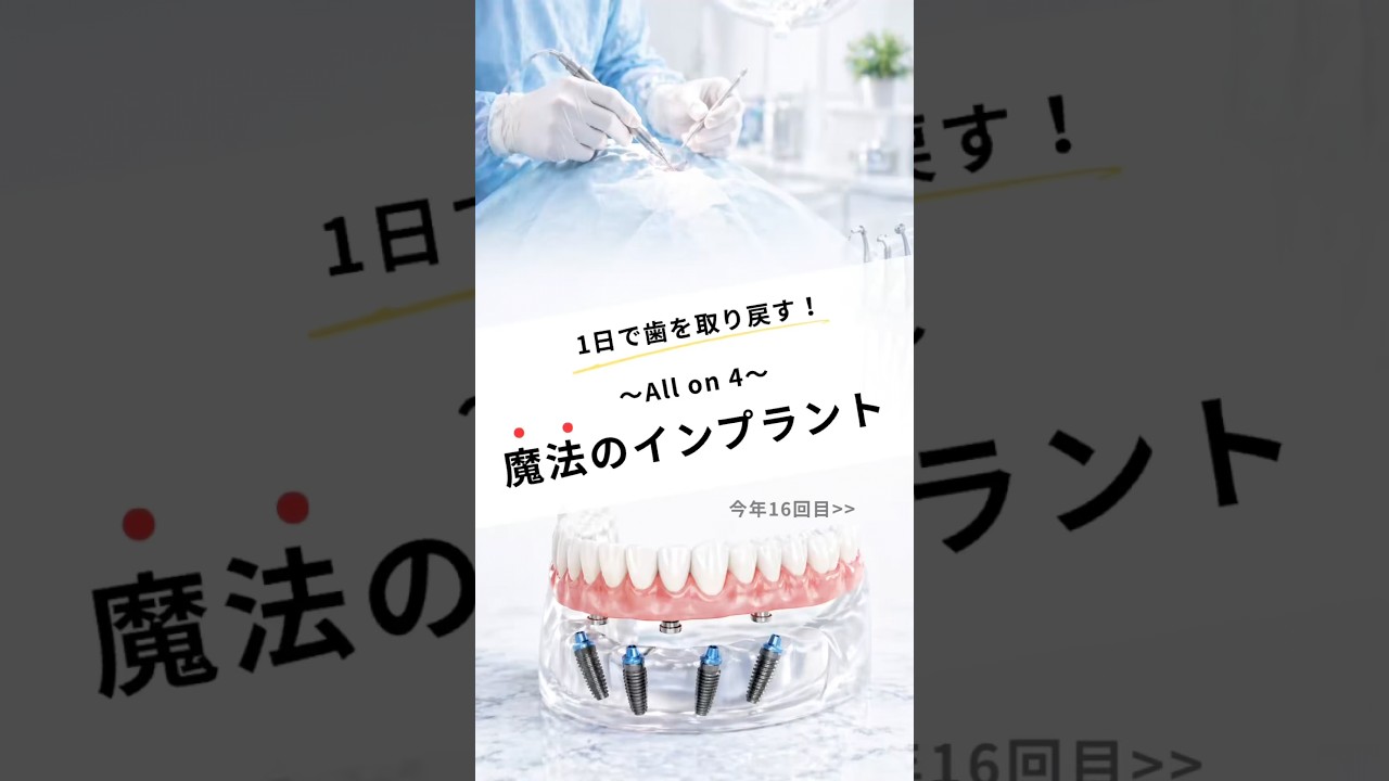 今年16回目のオールオン4のオペです！　#なかの歯科 #岡山歯医者 #インプラント治療 #オールオン4 #allon4