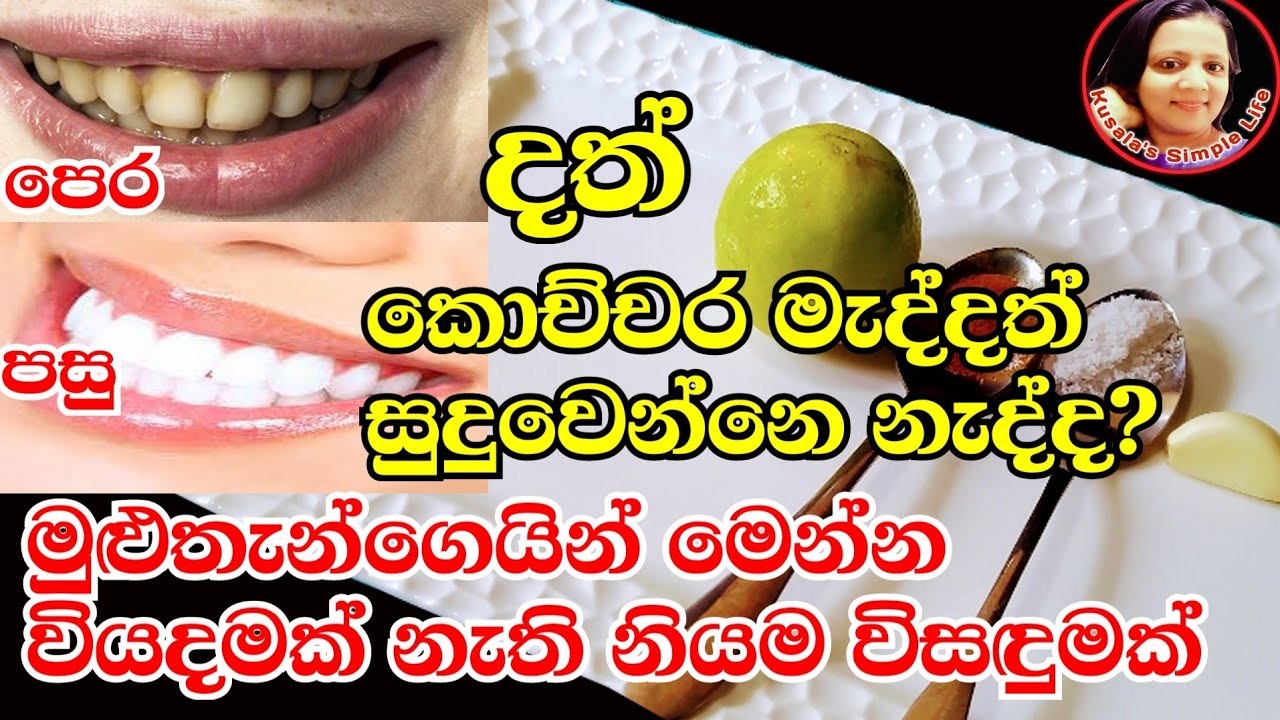 දත්වල යවන්න බැරි කහට අරිමු - Great solution from the kitchen for your dirty teeth by Kusala's Simple