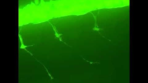 GFP labelled motor neurons in a live zebrafish embryo