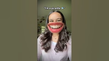 Silly braces transition 🤪🦷 #fypシ゚ #funny #braces #teen #transition #trend #shorts #viral