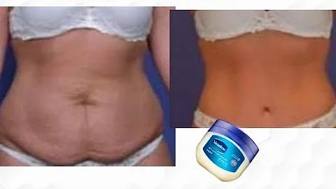 how to get rid of saggy stomach fast in 7 days - DayDayNews