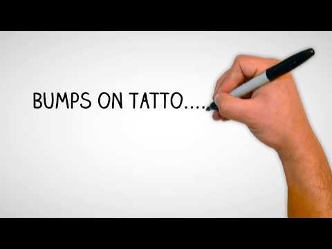 bumps-on-tattoo--is-it-possible-to-have-keratosis-pilaris-and-tattoos?