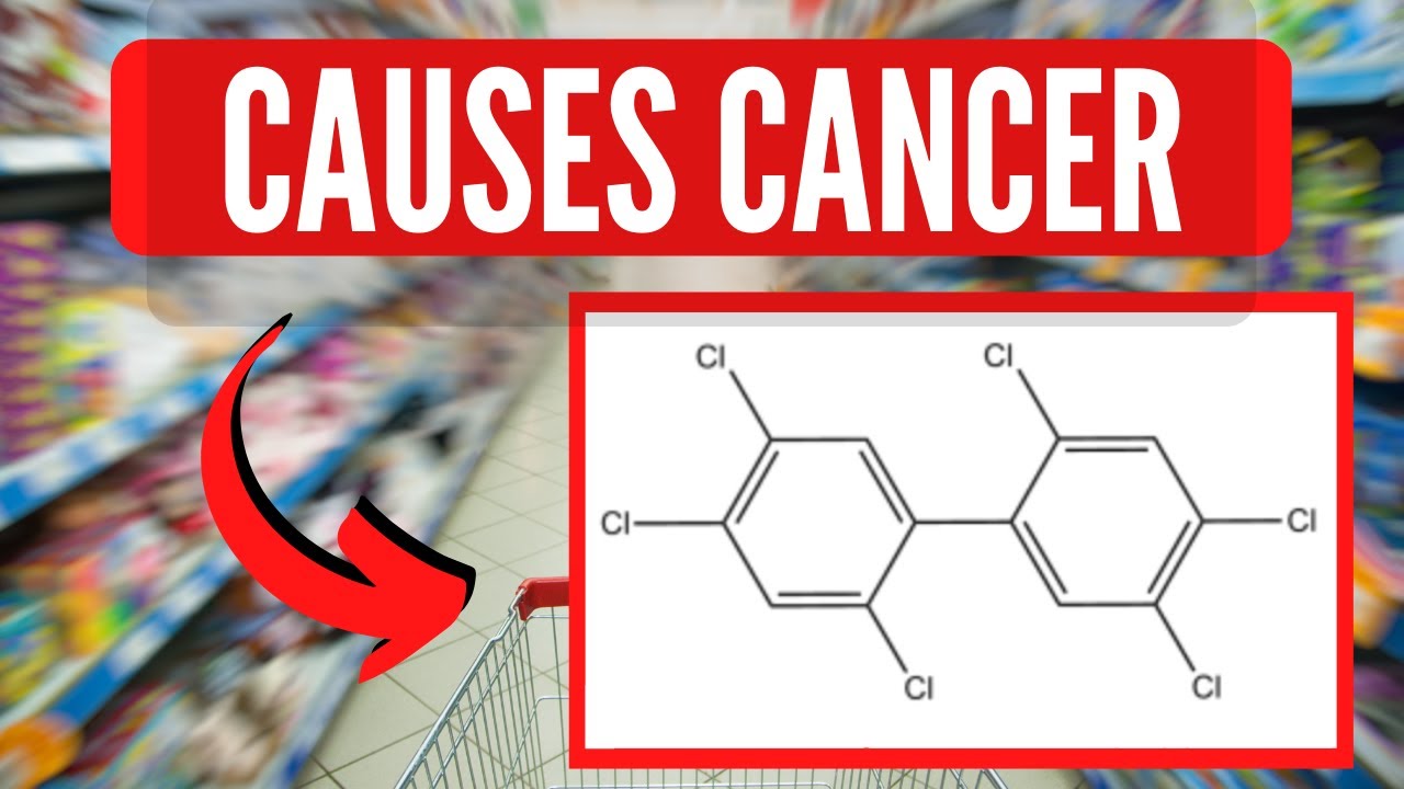 4 Common Causes Of CANCER That Most People Don't Know About 