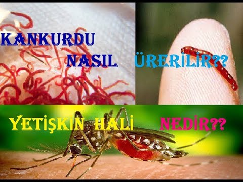 Video: Kan Kurdu Nasıl Yetiştirilir