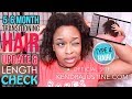 5 &amp; 6 Month Transitioning Hair Update + Dandruff Treatment