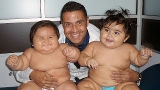 Fat Babies: Charity Aids Obese Babies In Bid To Lose Weight