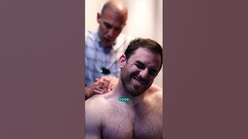 This Active Release Technique Made His Eye Wink on Its Own!