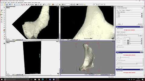 Tutorial   05   Basic Visualisation And Saving An Image In Vgstudiomax 2 And 3