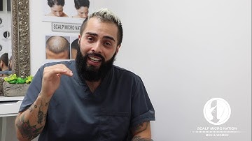 Micro Scalp Pigmentation in Orange County | Scalp Micro Pigmentation Artist Shane Herrera