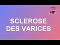 Sclrose des varices