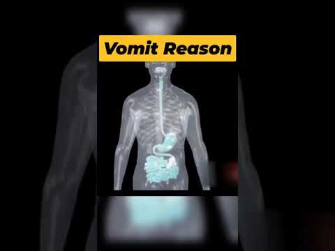 Reason of vomit happen 🤮 #bodyinsight #3danimation