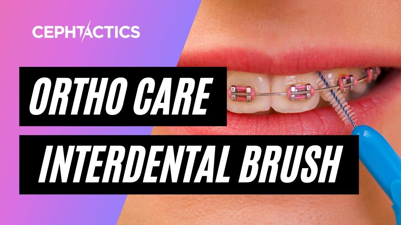 Interdental Brush How to use (Orthodontic Care) YouTube