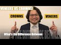Veneers VS Crowns | Apostol Dental Philippines