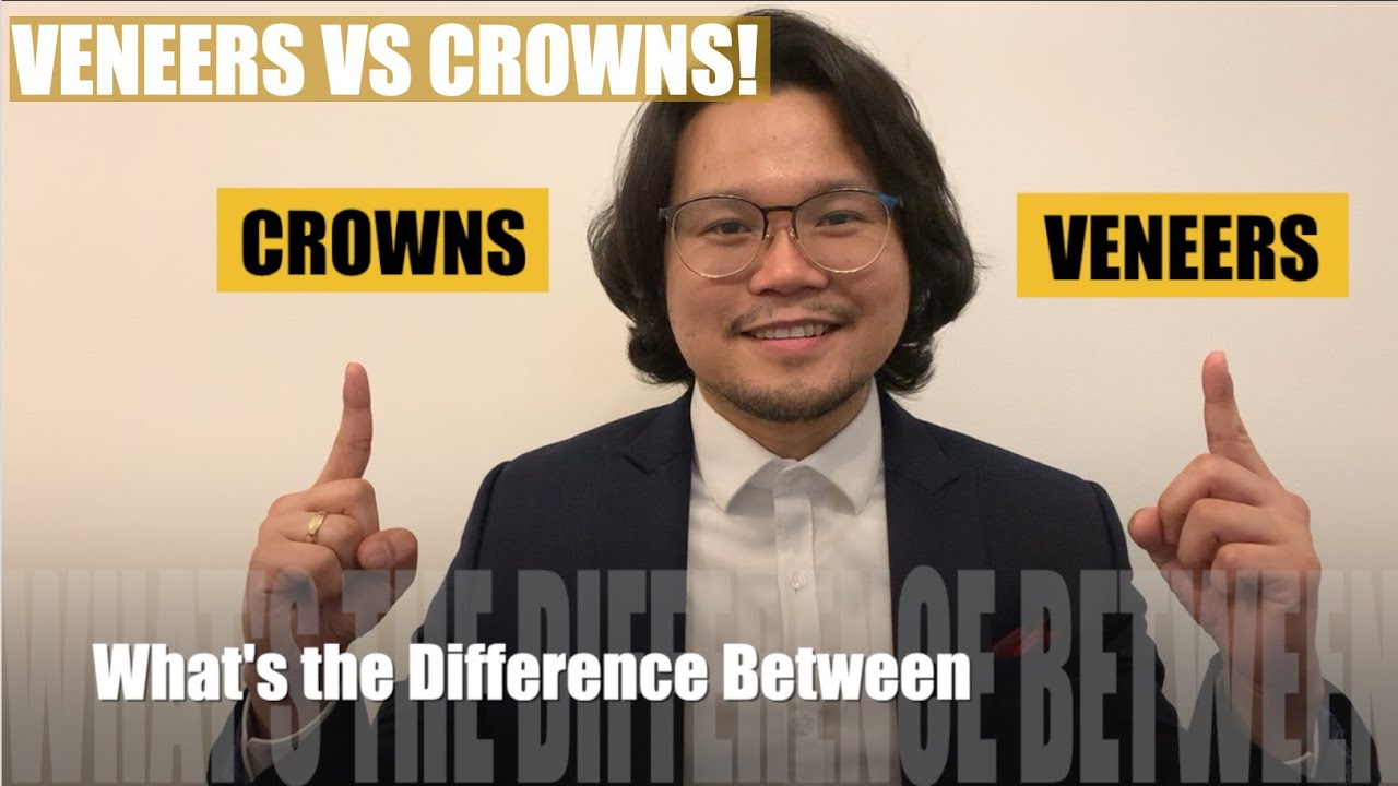 Veneers VS Crowns Apostol Dental Philippines YouTube