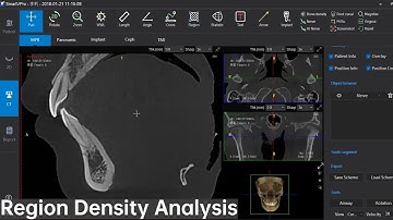 Dental Cone Beam CT software Single function display, LargeV SmartVPro, Region Density Analysis