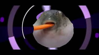 ShotGunRaids Pufferfish Remix