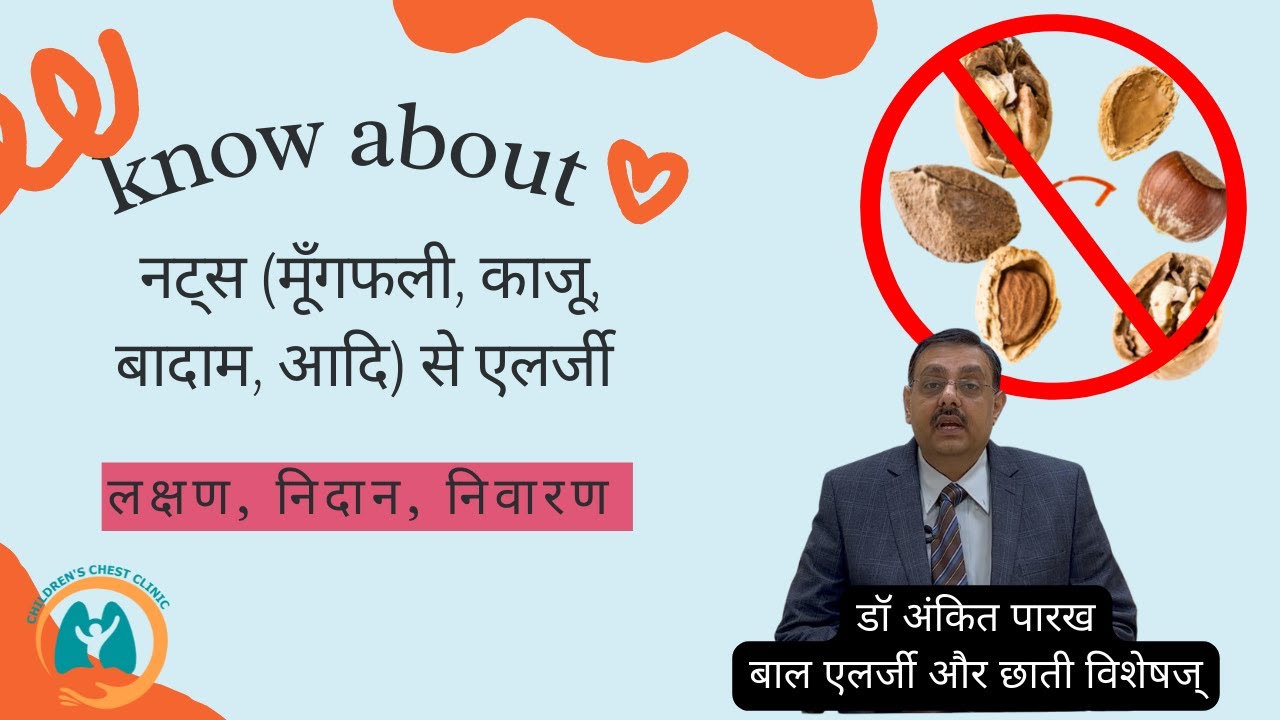 नट्स (मूँगफली, काजू, बादाम, आदि) से एलर्जी: लक्षण, निदान, निवारण