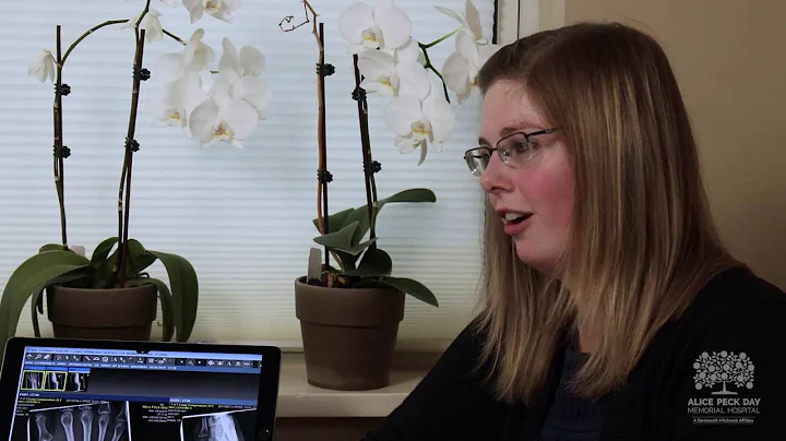 Answers for Living with Rheumatoid Arthritis: Kate...
