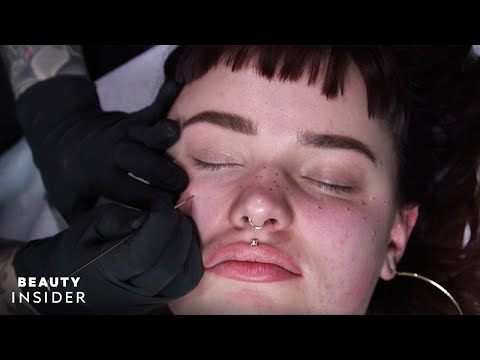 ვიდეო: Freckles– ის მიღების 4 გზა