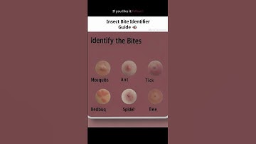 Who Bit You Find Out! 🐜