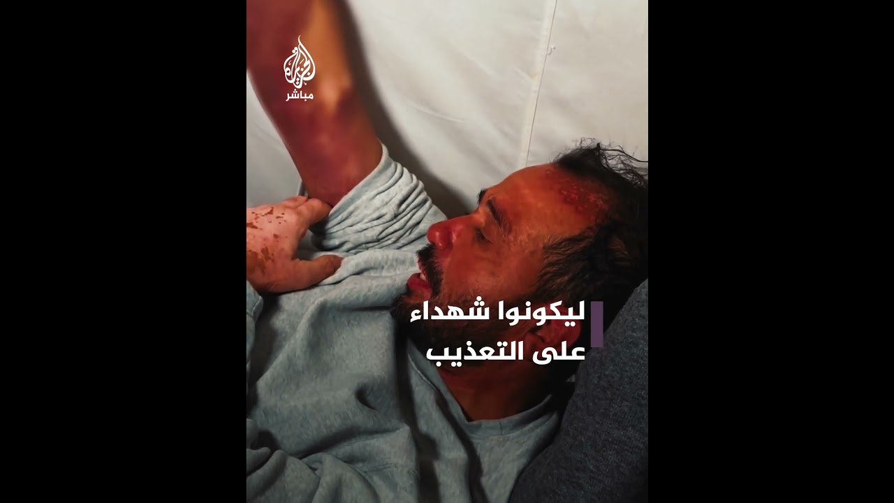 يعانون من وطأة التعذيب.. لقطات مرعبة لمعتقلين من غزة أفرج عنهم الاحتلال