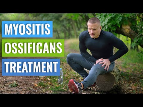 Video: Ossifying Myositis - Causes, Symptoms And Treatment