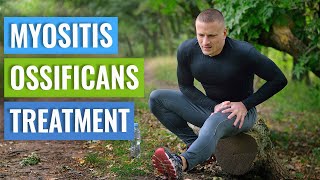Myositis Ossificans: Causes & Treatment