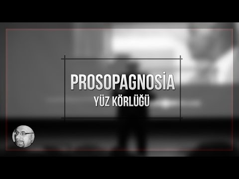 Prosopagnosia Yüz Körlüğü