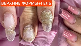 КОРРЕКЦИЯ НАРАЩИВАНИЯ ТИПСАМИ🤢ВЕРХНИЕ ФОРМЫ