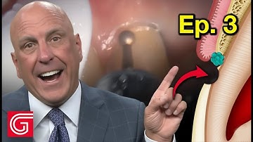 WHY I Prepare Gingival Margin FIRST for a Crown