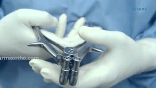 Anterior Cervical Plate - CORE Cervical Plate