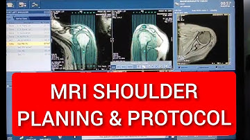 Shoulder MRI Protocol, Positioning and Planning, How to do MRI Shoulder, MRI Shoulder Education.