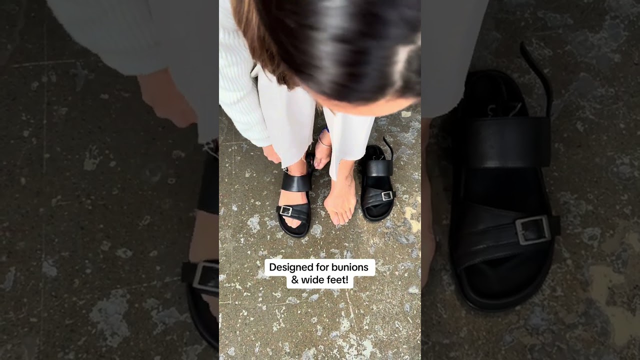 Style AND comfort for your bunions this summer 