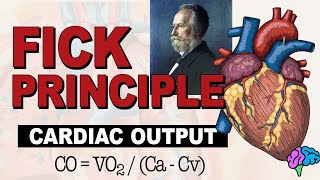 The Fick Principle for Determining Cardiac Output