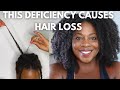 Vitamin D Deficiency is Causing Hair Loss+ Solutions |Ayurvedic Hair challenge Week 8