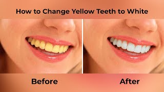 How To Whiten Teeth In Photoshop? - Photoshop Tutorial screenshot 5