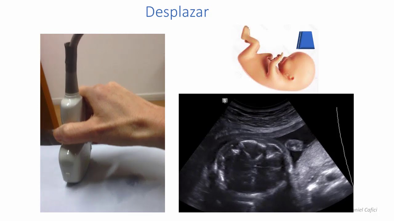 Como lo hago y biometria