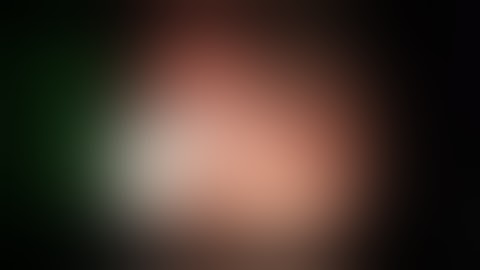 GIST – Treatment (EFTR) with the GERDX™-System (by G-SURG™ GmbH) Video © Prof. Karel Caca