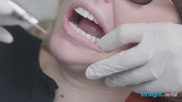 QuickSleeper: handleiding