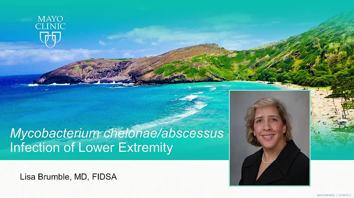 Mycobacterium Chelone/Abscesses Infection of Lower Extremity by Lisa Brumble, MD | Preview