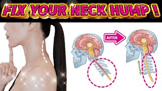 How to Fix a Neck Hump and Slim Face | Can be done while sitting in a chair