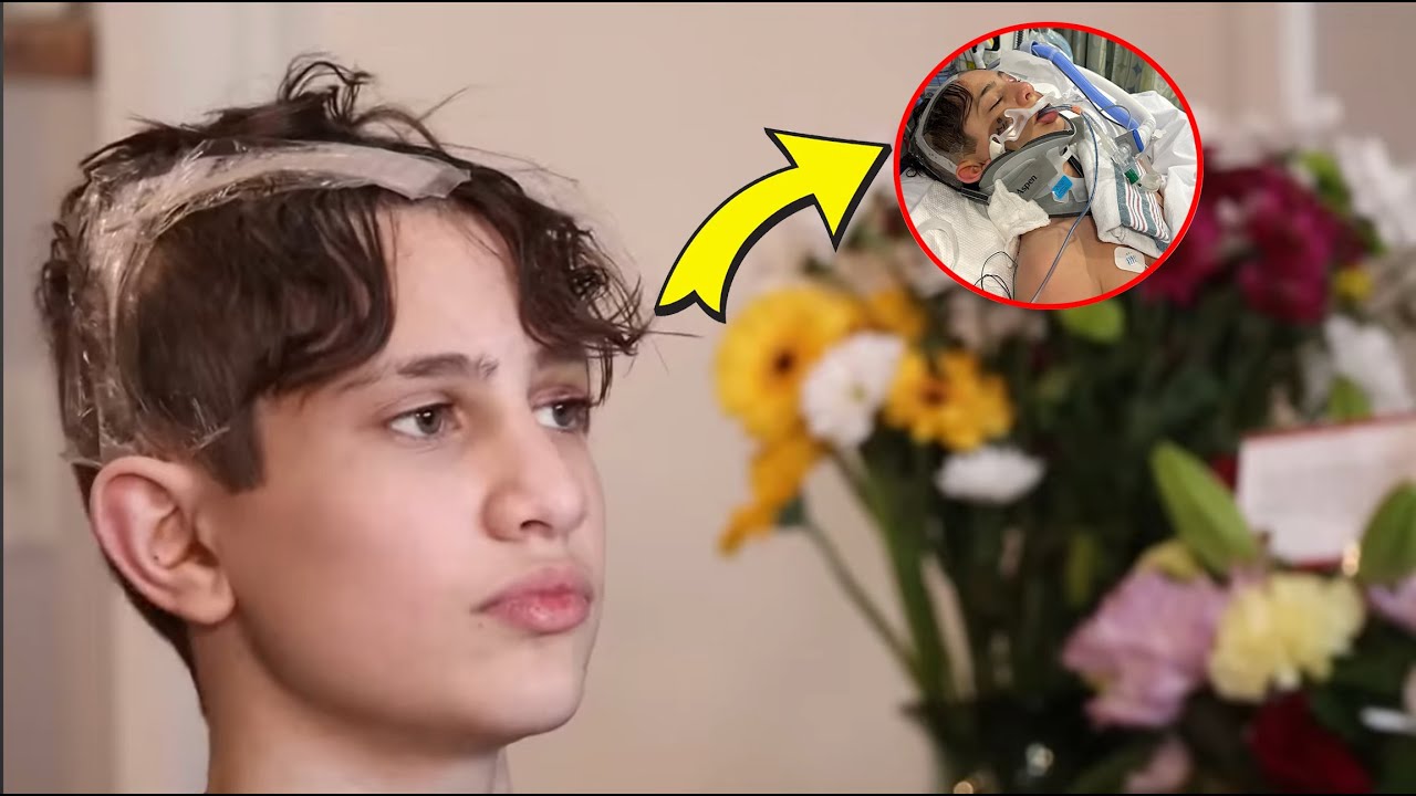 Nidal Explains His Scooter Accident.